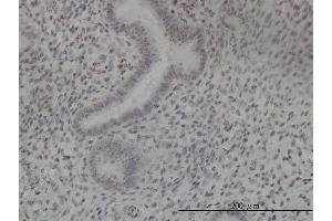 Immunoperoxidase of monoclonal antibody to NEK11 on formalin-fixed paraffin-embedded human endometrium tissue.