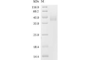 Tumor-Associated Calcium Signal Transducer 2 (TACSTD2) (AA 31-274) (Active) protein (His-Avi Tag)