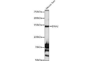 Western blot analysis of extracts of Mouse liver, using DN antibody (ABIN6135118 and ABIN6139689) at 1:1000 dilution. (DNA2 anticorps)
