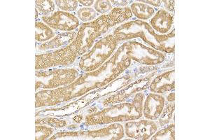 Immunohistochemistry of paraffin-embedded mouse kidney using USP9Y Rabbit pAb (ABIN7271171) at dilution of 1:150 (40x lens). (USP9Y anticorps)