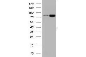 HEK293T cells were transfected with the pCMV6-ENTRY control (Left lane) or pCMV6-ENTRY DGKB (Right lane) cDNA for 48 hrs and lysed. (DGKB anticorps)