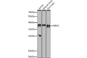 Western blot analysis of extracts of various cell lines, using MEK6 antibody (ABIN6130546, ABIN6143490, ABIN6143491 and ABIN6218471) at 1:1000 dilution. (MAP2K6 anticorps  (AA 1-334))
