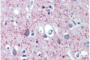 Human Brain, Cortex (formalin-fixed, paraffin-embedded) stained with MAP2 antibody ABIN462127 followed by biotinylated anti-mouse IgG secondary antibody ABIN481714, alkaline phosphatase-streptavidin and chromogen.