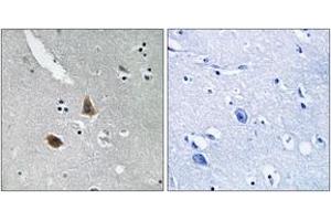 Immunohistochemistry analysis of paraffin-embedded human brain tissue, using MRPL21 Antibody.