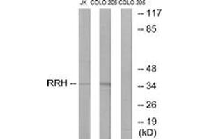 Western blot analysis of extracts from Jurkat/COLO cells, using RRH Antibody. (Peropsin anticorps  (AA 201-250))