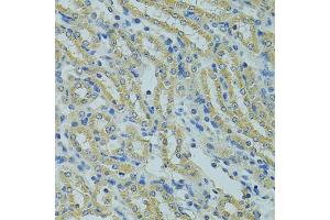 Immunohistochemistry of paraffin-embedded mouse kidney using PECR antibody (ABIN5975099) at dilution of 1/100 (40x lens). (PECR anticorps)