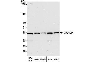 Western Blotting (WB) image for anti-Glyceraldehyde-3-Phosphate Dehydrogenase (GAPDH) (AA 150-200) antibody (ABIN7454519)