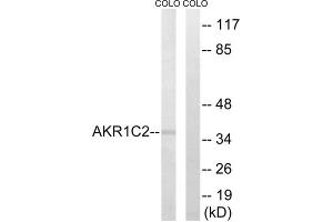 Western blot analysis of extracts from COLO cells, using AKR1C2 antibody. (AKR1C2 anticorps  (Internal Region))