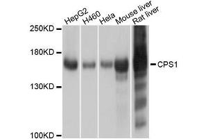 Western blot analysis of extracts of various cell lines, using CPS1 antibody. (CPS1 anticorps  (AA 820-930))