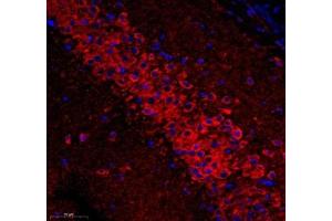 Immunofluorescence of paraffin embedded mouse hippocampus using ATP5A1 (ABIN7073141) at dilution of 1: 300 (300x lens)