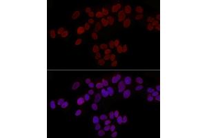 Immunofluorescence analysis of MCF7 cells using TMPO Rabbit pAb (ABIN3016206, ABIN3016207, ABIN3016208, ABIN1683056 and ABIN1683057) at dilution of 1:50 (40x lens).