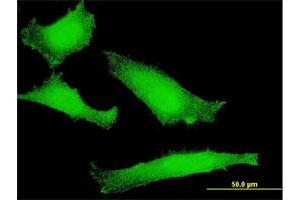 Immunofluorescence of monoclonal antibody to FOXO1 on HeLa cell. (FOXO1 anticorps  (AA 556-655))