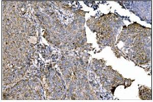 IHC analysis of Ornithine Aminotransferase/OAT using anti-Ornithine Aminotransferase/OAT antibody (ABIN7600649). (OAT anticorps  (AA 214-439))