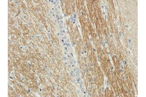 Immunohistochemical staining of rabbit brain using anti-CDCrel-1 antibody ABIN7072252 Formalin fixed rabbit brain slices were were stained with ABIN7072250 at 3 μg/mL. (Recombinant Septin 5 anticorps)