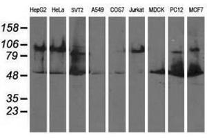 Image no. 2 for anti-Dihydrolipoamide Dehydrogenase (DLD) antibody (ABIN1497849) (DLD anticorps)