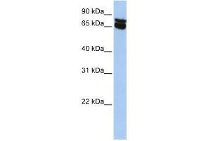 WB Suggested Anti-B4GALNT1 Antibody Titration:  0. (B4GALNT1 anticorps  (N-Term))