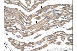 C1QB antibody was used for immunohistochemistry at a concentration of 4-8 ug/ml. (C1QB anticorps  (C-Term))
