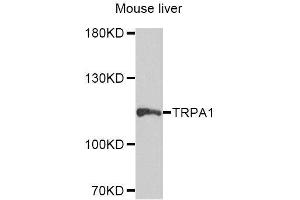 Western blot analysis of extracts of mouse liver, using TRPA1 antibody (ABIN5996346) at 1/1000 dilution. (TRPA1 anticorps)