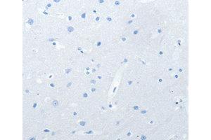 Immunohistochemistry (IHC) image for anti-Neurofascin (NFASC) antibody (ABIN1873888) (NFASC anticorps)