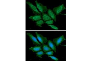 ICC/IF analysis of BPGM in HeLa cells line, stained with DAPI (Blue) for nucleus staining and monoclonal anti-human BPGM antibody (1:100) with goat anti-mouse IgG-Alexa fluor 488 conjugate (Green).