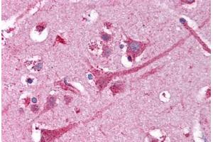 Human Brain, Cortex (formalin-fixed, paraffin-embedded) stained with NEK9 antibody ABIN218339 at 1:50 followed by biotinylated goat anti-rabbit IgG secondary antibody ABIN481713, alkaline phosphatase-streptavidin and chromogen. (NEK9 anticorps)