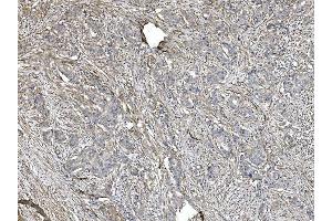 IHC analysis of Filamin A/FLNA using anti-Filamin A/FLNA antibody (ABIN7601783). (Filamin A anticorps  (AA 451-638))