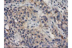 Image no. 4 for anti-Breast Cancer Anti-Estrogen Resistance 1 (BCAR1) antibody (ABIN1496833)