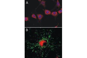 A: Indirect immunolabeling of 3T3 cells (dilution 1 : 500).