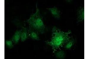 Immunofluorescence (IF) image for anti-Protein Kinase, CAMP-Dependent, Regulatory, Type I, beta (PRKAR1B) antibody (ABIN1500406)