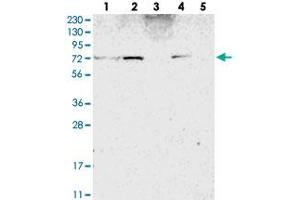 Western blot analysis of Lane 1: RT-4, Lane 2: U-251 MG, Lane 3: Human Plasma, Lane 4: Liver, Lane 5: Tonsil with ZNF846 polyclonal antibody .