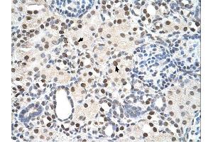 PSME3 antibody was used for immunohistochemistry at a concentration of 4-8 ug/ml. (PSME3 anticorps  (N-Term))