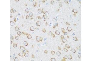 Immunohistochemistry of paraffin-embedded Mouse brain using DHODH Polyclonal Antibody at dilution of 1:100 (40x lens). (DHODH anticorps)
