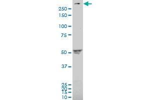 ABCA4 polyclonal antibody (A01), Lot # 051109JC01 Western Blot analysis of ABCA4 expression in SJCRH30 .