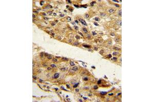 Immunohistochemistry (IHC) image for anti-serpin Peptidase Inhibitor, Clade F (Alpha-2 Antiplasmin, Pigment Epithelium Derived Factor), Member 1 (SERPINF1) antibody (ABIN3003134)