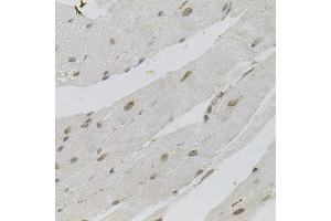 Immunohistochemistry of paraffin-embedded mouse heart using SRSF9 antibody (ABIN5973601) (40x lens). (SFRS9 anticorps)