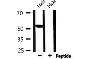 Western blot analysis of extracts from Hela, using TINF2 Antibody. (TINF2 anticorps  (Internal Region))