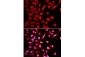 Immunofluorescence analysis of U2OS cells using PSMC3 antibody. (PSMC3 anticorps  (AA 1-180))