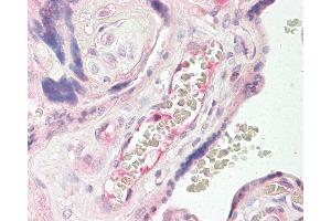 Anti-TEM7 antibody IHC of human placenta. (PLXDC1 anticorps  (AA 74-123))