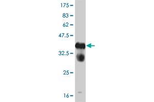 Western Blot detection against Immunogen (37. (FGFR1 anticorps  (AA 303-408))