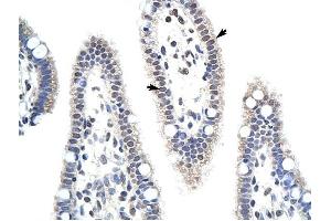 MDS032 antibody was used for immunohistochemistry at a concentration of 4-8 ug/ml to stain Epithelial cells of intestinal villus (arrows) in Human Intestine.