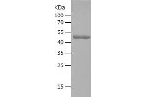 Western Blotting (WB) image for Squamous Cell Carcinoma Antigen Recognized By T Cells 3 (SART3) (AA 19-207) protein (His-IF2DI Tag) (ABIN7125198)