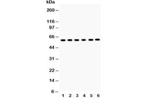 Western blot testing of EAAT2 antibody and Lane 1:  rat brain;  2: mouse brain;  3: U87;  4: SMMC-7721;  5: PANC;  6: A549;  Predicted size: 62KD;  Observed size: 62KD (SLC1A2 anticorps  (AA 461-574))