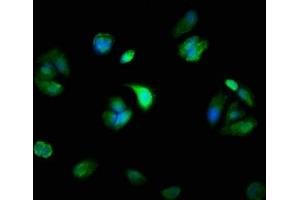Immunofluorescence staining of MCF-7 cells with ABIN7160568 at 1:100, counter-stained with DAPI.