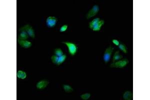 Immunofluorescence staining of MCF-7 cells with ABIN7160568 at 1:100, counter-stained with DAPI. (Myosin anticorps  (AA 1058-1195))