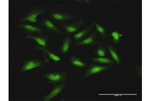 Immunofluorescence of purified MaxPab antibody to STOM on HeLa cell. (Stomatin anticorps  (AA 1-288))