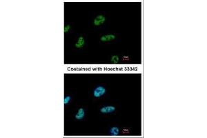 ICC/IF Image Immunofluorescence analysis of paraformaldehyde-fixed HeLa, using CHD4, antibody at 1:500 dilution.