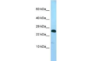 WB Suggested Anti-Ndufv2 Antibody Titration: 1. (NDUFV2 anticorps  (N-Term))
