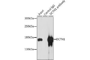 Immunoprecipitation analysis of 200 μg extracts of MCF-7 cells, using 3 μg DCTN1 antibody (ABIN3022541, ABIN3022542, ABIN3022543 and ABIN6218891). (Dynactin 1 anticorps  (AA 945-1139))