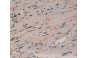 Used in DAB staining on fromalin fixed paraffin- embedded Kidney tissue