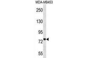 Western Blotting (WB) image for anti-Zinc Finger Protein 16 (ZNF16) antibody (ABIN2999236)